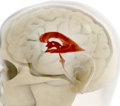 Hjärnans hålrum – ventriklarna
